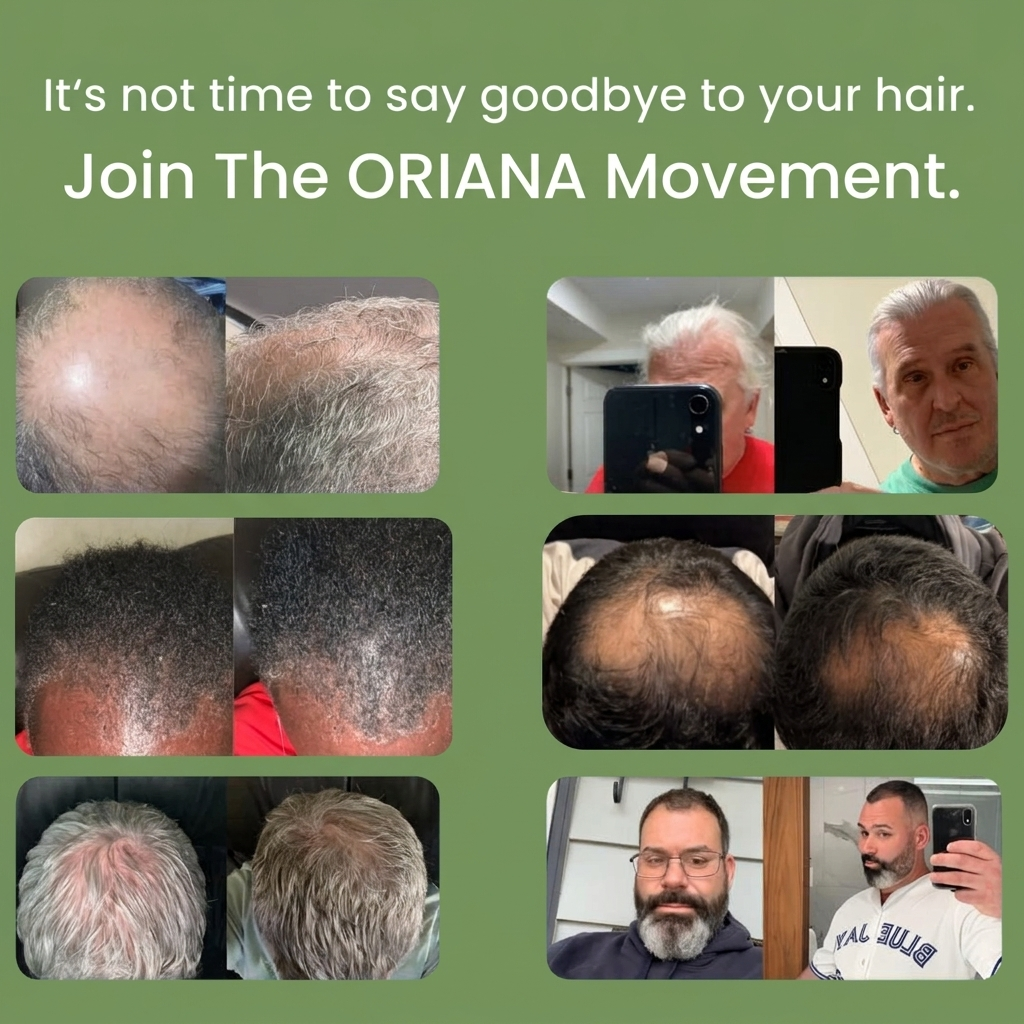 Oriana™ Hair Regrowth System